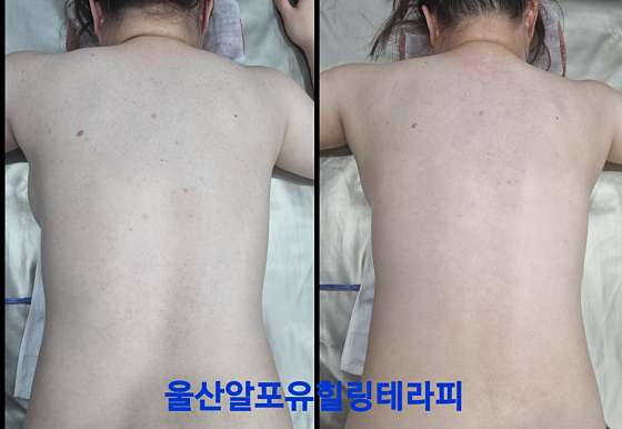 울산.남구-삼산동-R4U 힐링테라피-17 | 실내이미지 | 마짱