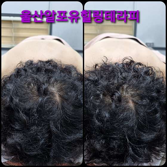 울산.남구-삼산동-R4U 힐링테라피-14 | 실내이미지 | 마짱