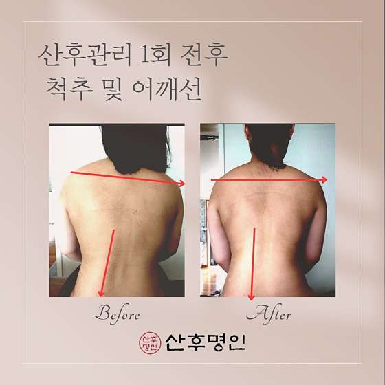 경기.화성시-영천동-산후명인 동탄본점-1 | 실내이미지 | 마짱
