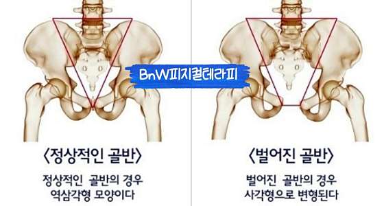 인천.연수구-송도동-BnW피지컬테라피-4 | 실내이미지 | 마짱