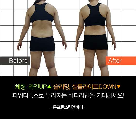 경남.진주시-장대동-롬프란 스킨앤바디-18 | 실내이미지 | 마짱