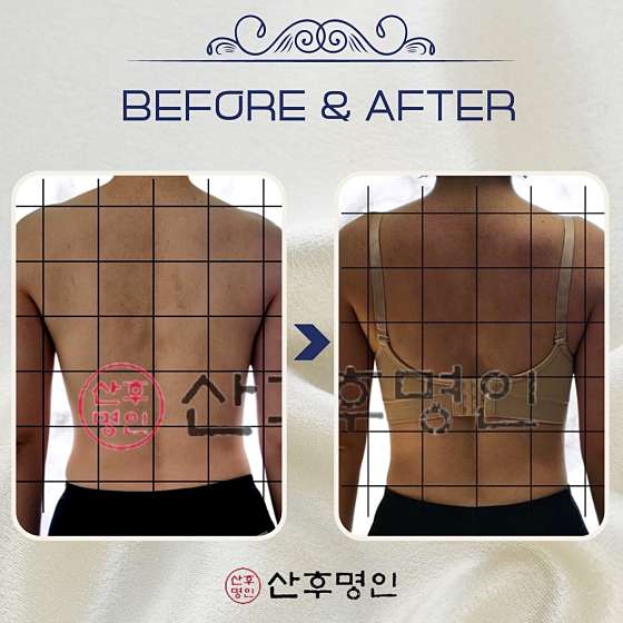 경기.용인시-처인구-산후명인 용인점-17 | 실내이미지 | 마짱